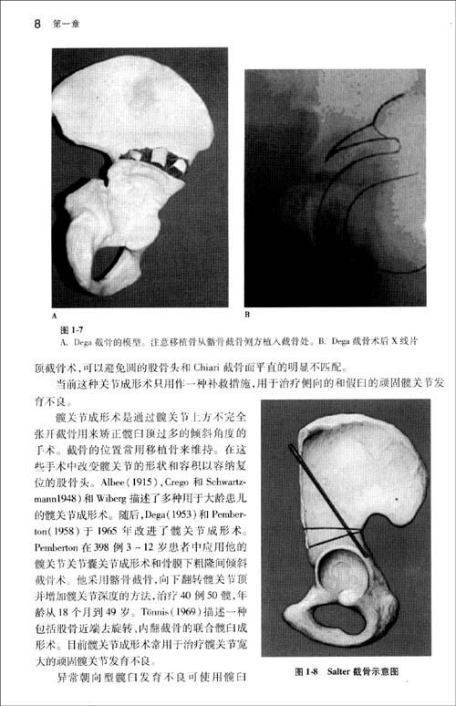 20 普通外科手术学——手术学全集(第 3 85.