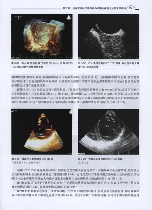 经食管实时3维超声心动图图谱