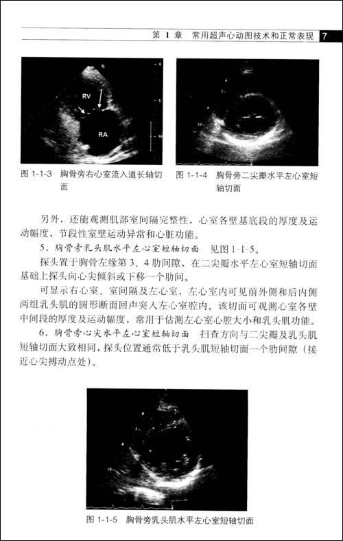 《超声心动图指南》()【简介|评价|摘要|在线阅读】-国美在线新华文轩