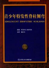 青少年特发性脊柱侧弯