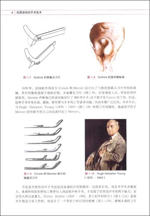 微创除皱_微创尿道后多久恢复_经尿道微创技术