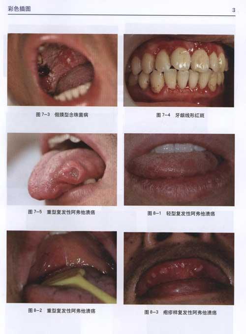 李秉琦实用口腔黏膜病学