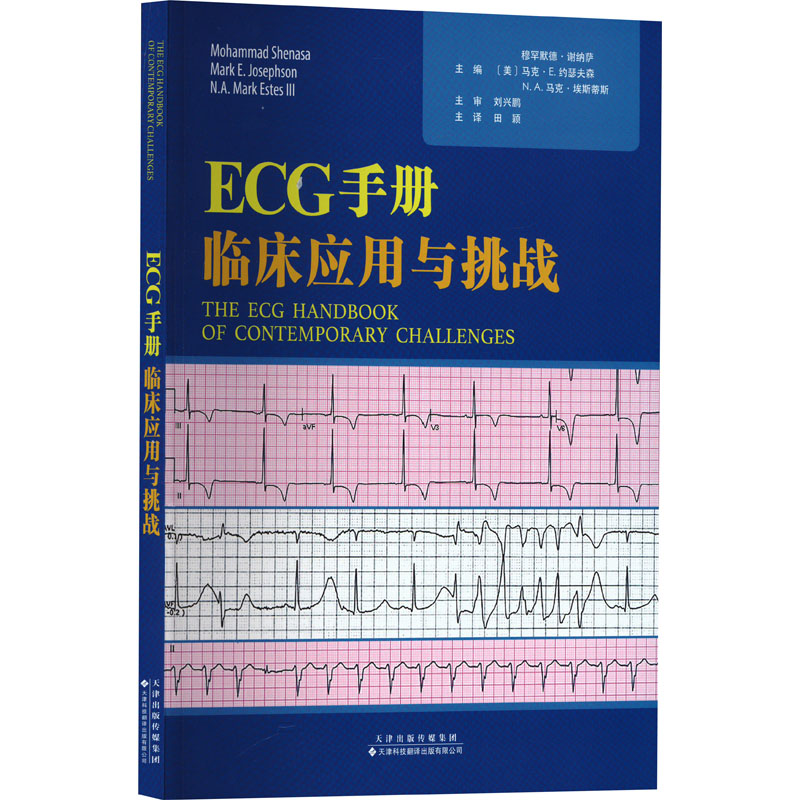ECG手册 临床应用与挑战