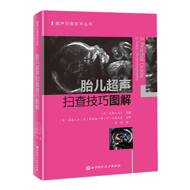 胎儿超声扫查技巧图解 如何重构你的产前超声认知 从解剖-标准切面-扫查方法-精准诊断 直击胎儿超声核心战场！ 