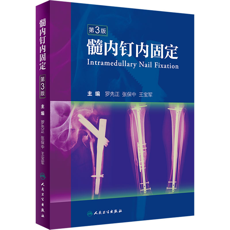  髓内钉内固定 第3版 