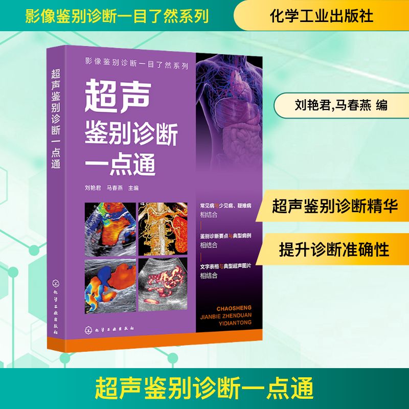  超声鉴别诊断一点通 几百张高清超声图片+病灶指示箭头+鉴别要点表格，常见病、、少见病、罕见病诊断与鉴别诊断一目了然！ 