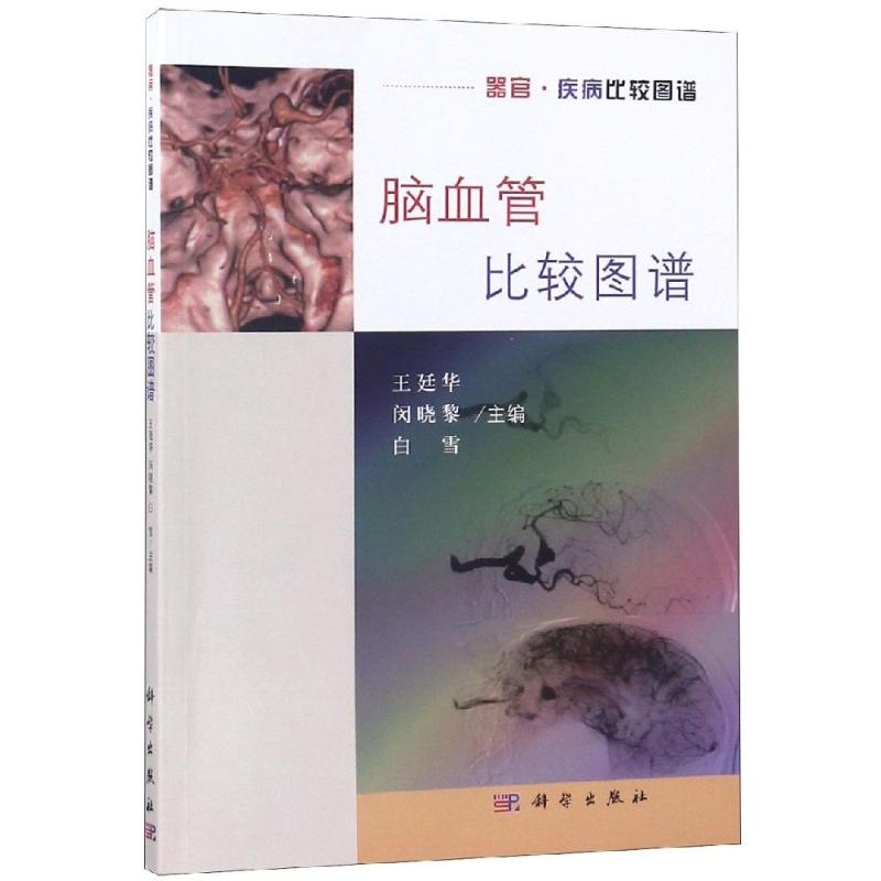  脑血管比较图谱 